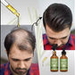 BUNEE Rosemary Hair Growth Serum Oil