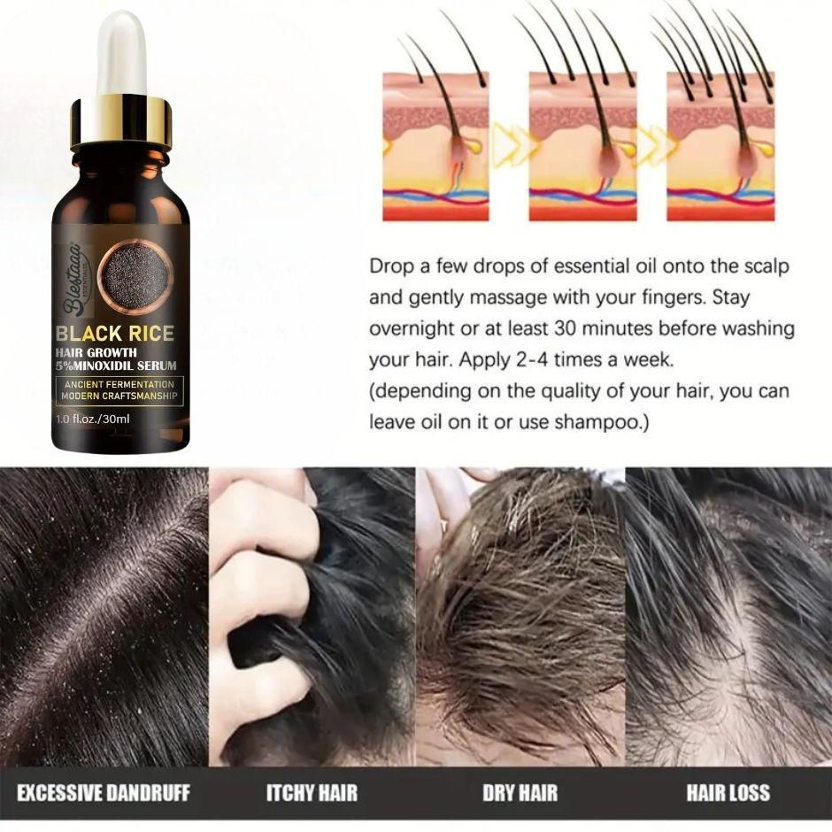 Hair Growth Serum With Biotin And Castor